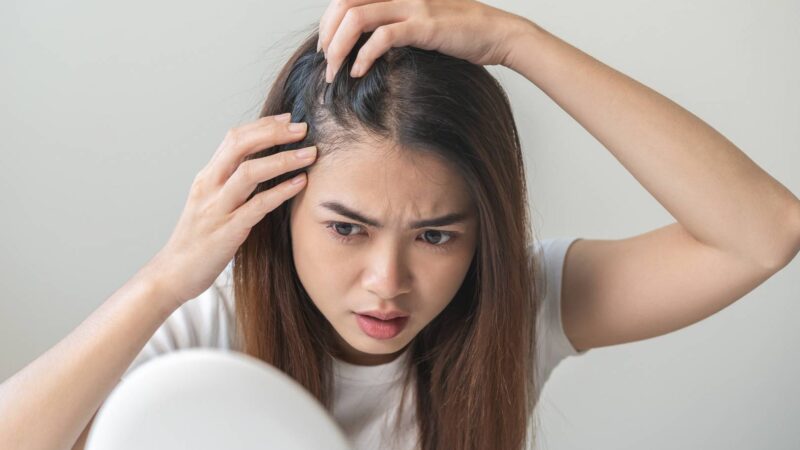 Pielęgnacja włosów z łupieżem – co robić, żeby pozbyć się problemu?